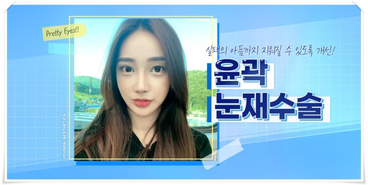 Tái phẫu thuật mắt tại Seoul một cách chắc chắn