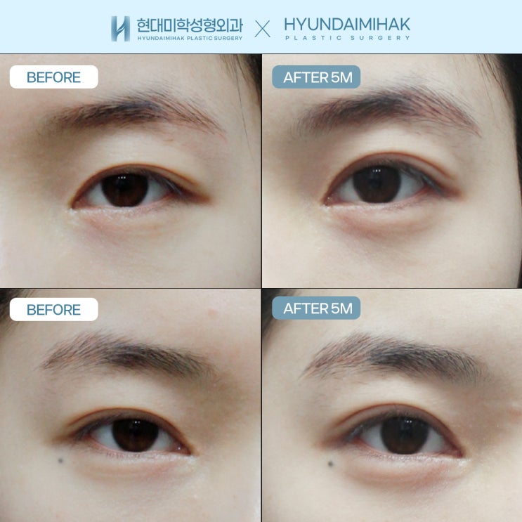 Nếu bạn muốn tạo sự khác biệt tại nơi làm chỉnh hình mắt đẹp