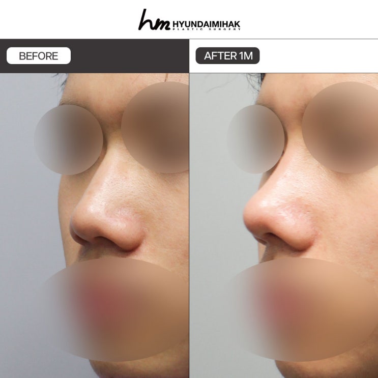 Review phẫu thuật thẩm mỹ nam: tỷ lệ thành công khi hẹn hò mai mối sẽ thay đổi
