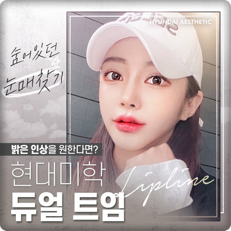 Dual Canthoplasty tại Thẩm mỹ Hyundai, nơi thực hiện mắt hai mí và thẩm mỹ mắt đẹp, giúp đôi mắt trông thoáng sáng hơn
