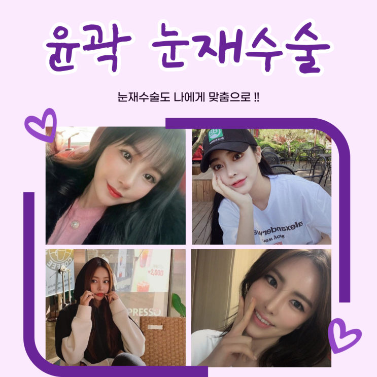Tái phẫu thuật mắt tại Seoul: những điều nhất định cần biết.