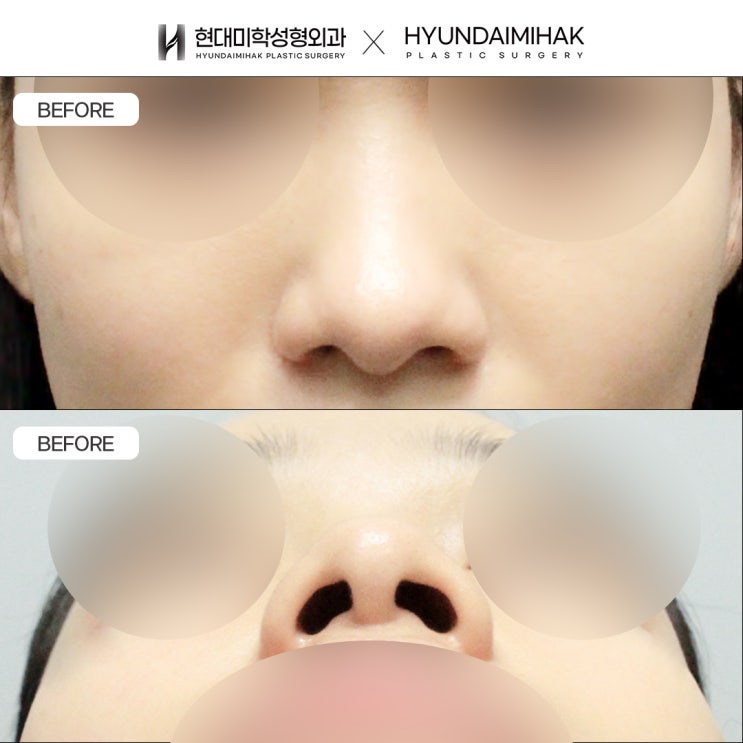 Một bệnh viện thẩm mỹ mũi nổi tiếng không chỉ đơn thuần nâng mũi thật cao