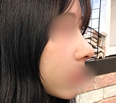 Gương mặt tôi có chiều sâu hơn rồi haha