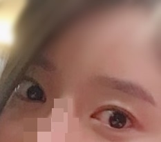 Tôi rất hài lòng với chỉnh cơ nâng mi!