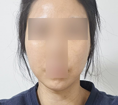 Đường nét khuôn mặt gọn gàng -