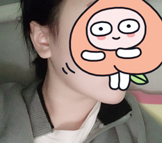 Mo cam bien mat nho hut mo mat