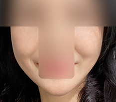 Mình hài lòng với căng chỉ