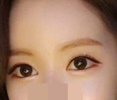Làm mở góc mắt xong mình đẹp hơn