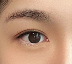 Mình đã sửa mí đôi