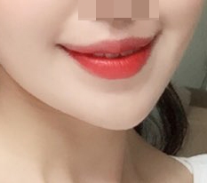 My mouth corners look so natural!