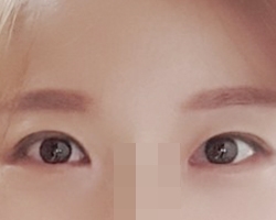 Đôi mắt đúng là nước đi thần thánh