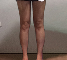 I made a thigh gap