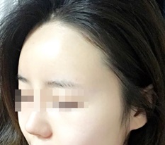 Vầng trán như không phải của tôi mà lại là của tôi : )