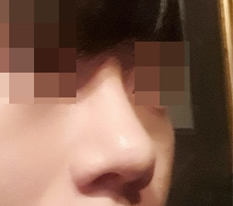Mũi nam cũng được làm hoàn hảo.