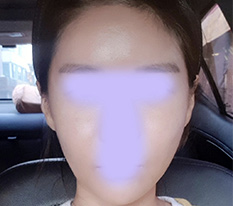 When my facial line changed, my whole vibe changed too!