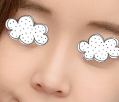Sau khi nâng mũi, tôi đang hẹn hò~