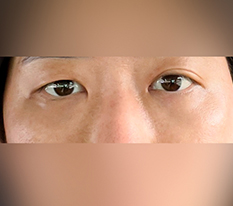 Hiệu quả khá ổn