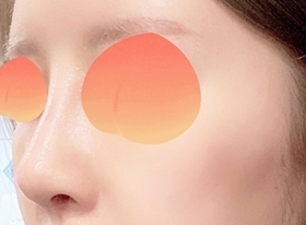 Thẩm mỹ Hyundai is great for noses hehe