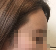 Nhờ vầng trán tròn đầy mà khuôn mặt trở nên lập thể hơn~ hehe