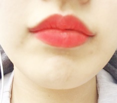 Nâng khóe miệng + đỉnh môi~♥