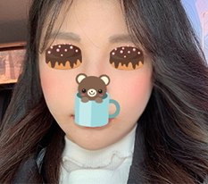 Phẫu thuật gò má làm lại của tôi đẹp lắm^^