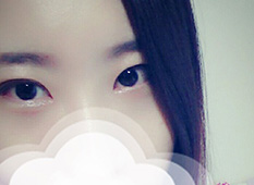 Phẫu thuật mắt tuyệt vời ㅋ