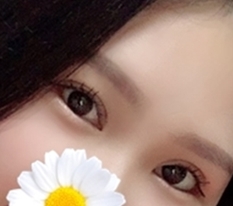 Tôi đã có lại đôi mắt rõ nét