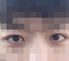 Đôi mí tôi từng muốn có