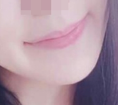 Khóe miệng quyến rũ hơn