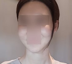 Khuôn mặt đã trở lại như xưa ㅎㅎ