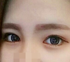 Chỉ làm mắt thôi mà tôi cảm giác như được sinh ra lại ㅠㅠ