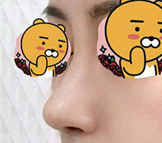 Không ngờ mức độ hài lòng sau phẫu thuật mũi lại cao đến vậy haha