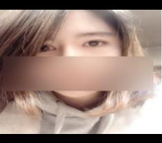 Review ngắn về cắt mí, mở góc mắt trong và phẫu thuật vách ngăn mũi