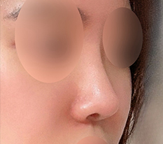 My nose came out so well