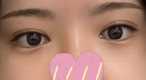 Review cắt mí với chi tiết hoàn hảo!!