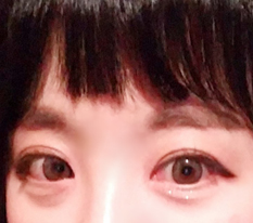 Mở khóe mắt đúng là quá đỉnh