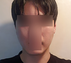 Hiệu quả tốt