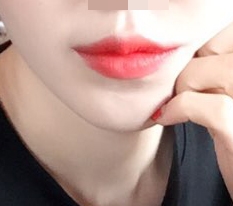 Khóe miệng của tôi đỉnh thật đó~~!!!