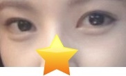 Thoát khỏi hai mắt không đều ㅋㅋ