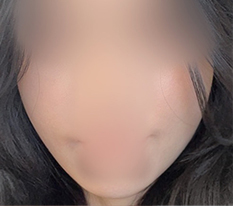 Trẻ ra trong một lần