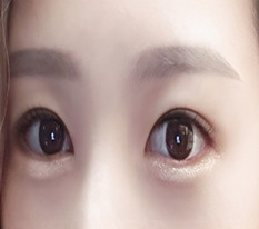 Bấm mí liên kết tự nhiên + mở đuôi và hạ mắt, tháng thứ 4