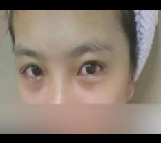 Mình rất thích mí đôi (cắt mí) và mở khóe kép :D