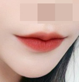 Môi chu~ ♥ Xinh lên nhiều không?