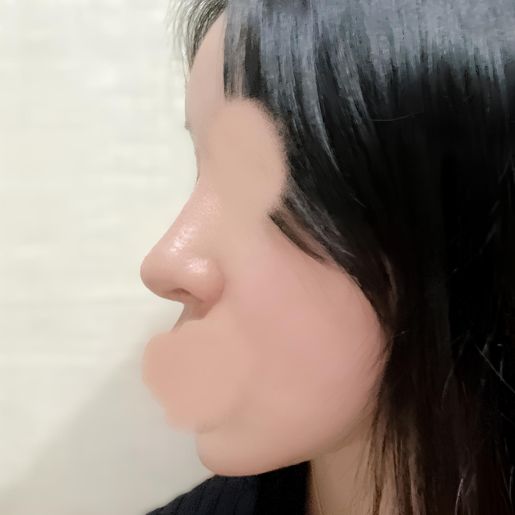 Từ mũi to bè thành mũi thẳng cong nhẹ thanh thoát