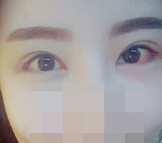Review sua mat + mo duoi + mo duoi mat + mo dau mat+_+