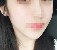 Thu gọn đầu cằm!! Review~