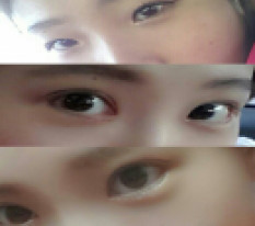 Tôi hoàn toàn hài lòng với đôi mắt hihi