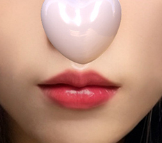 Phẫu thuật môi không để sẹo