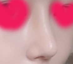 Người quen quanh mình náo loạn khi thấy mũi mình haha