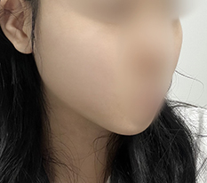 Mặt mình thon gọn hơn rồi!!